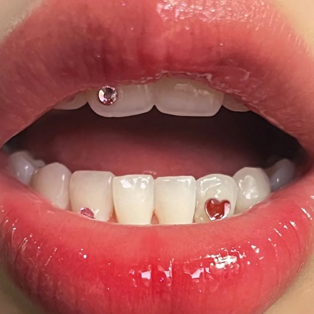 DIY Tooth Gems Kit