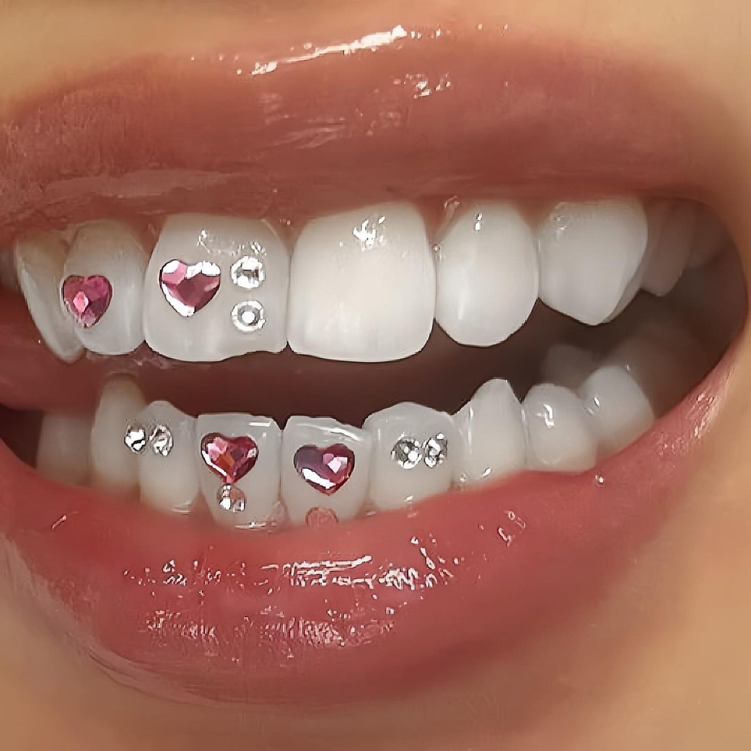 DIY Tooth Gems Kit