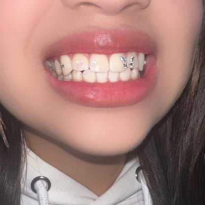 DIY Tooth Gems Kit