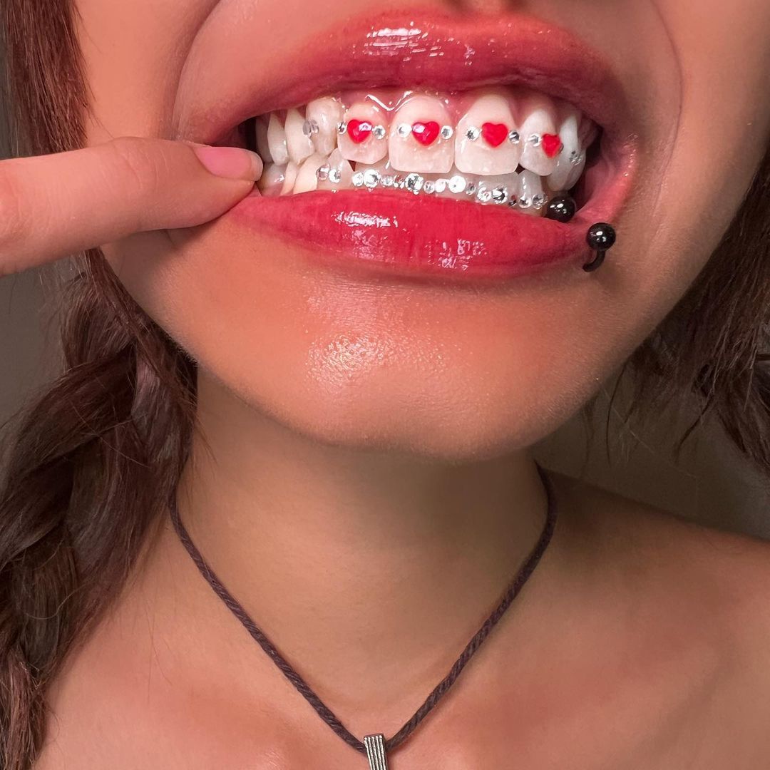 DIY Tooth Gems Kit